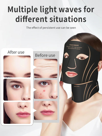 7-Color LED Face & Neck Mask – Wireless Silicone Phototherapy Rejuvenation Device
