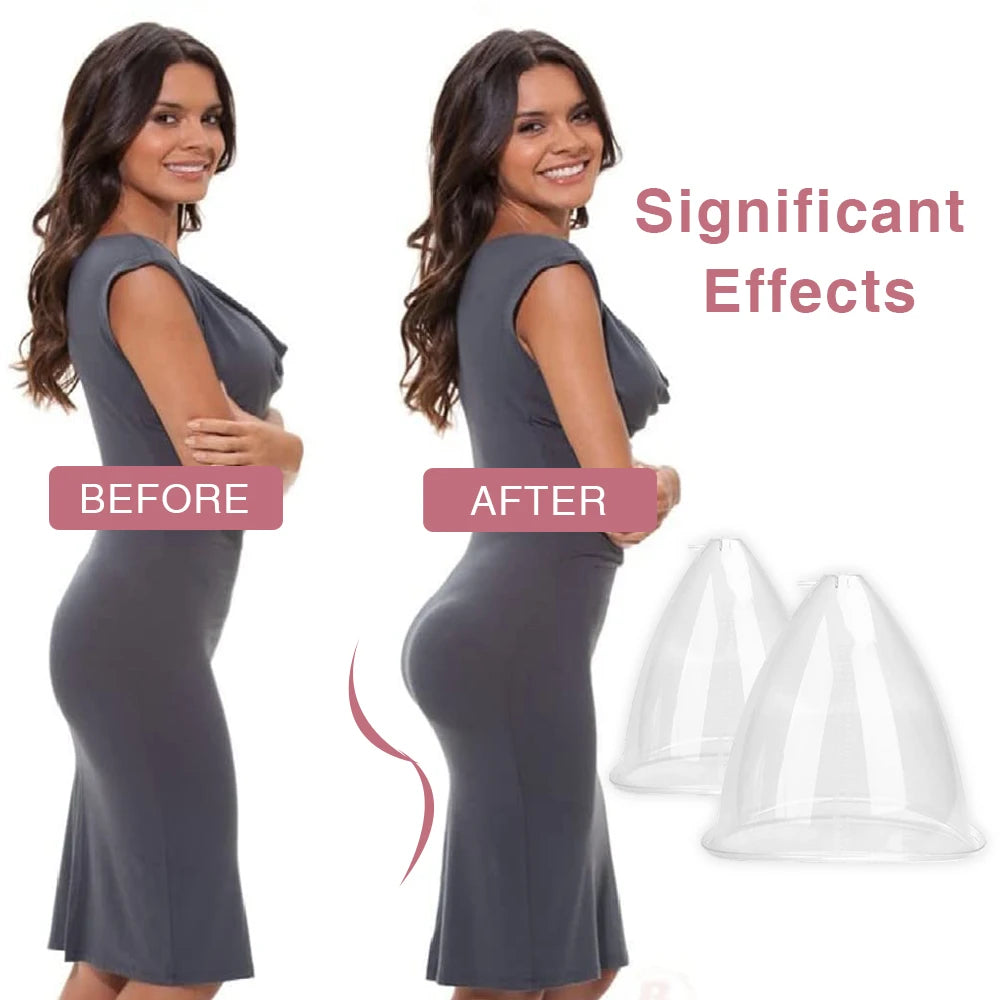 Professional Vacuum Cupping Therapy Set for Body Sculpting & Lifting - 6