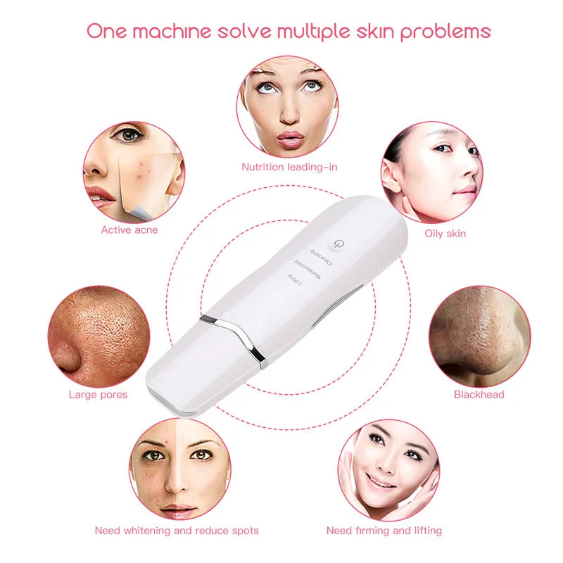 3-in-1 Ultrasonic Skin Scrubber & Facial Deep Cleansing Spatula Tool - 10