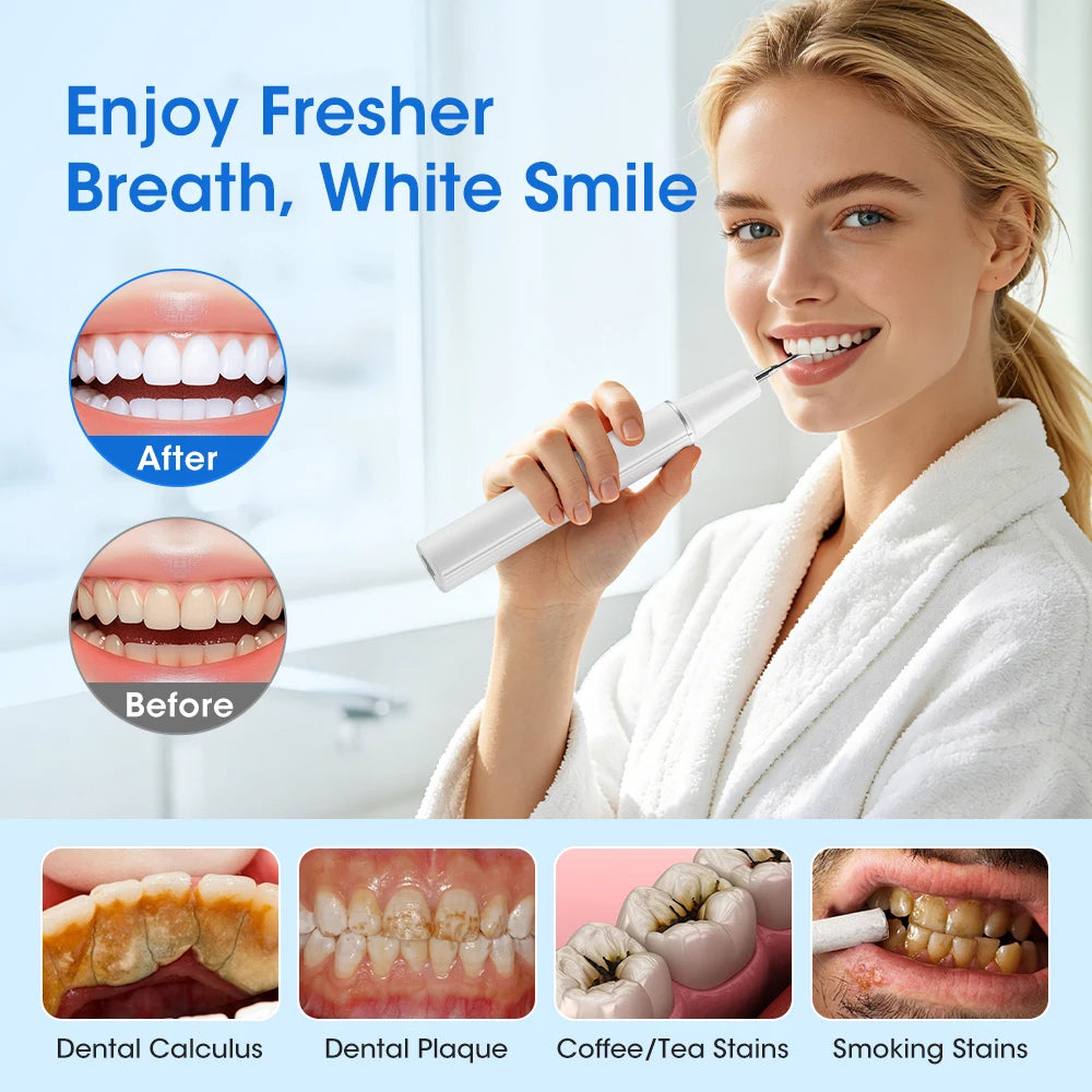 Ultrasonic Electric Teeth Cleaner & Tartar Plaque Remover for Professional Oral Care - 11