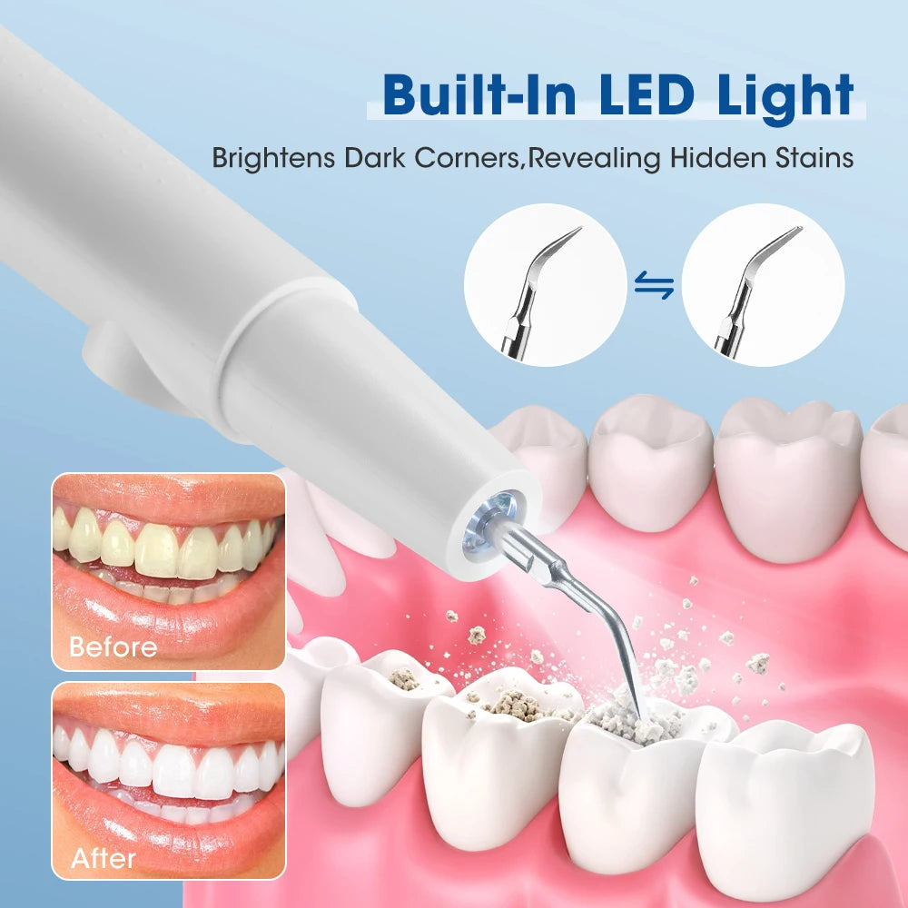 Ultrasonic Teeth Cleaner - Electric Tartar & Plaque Remover for Oral Care