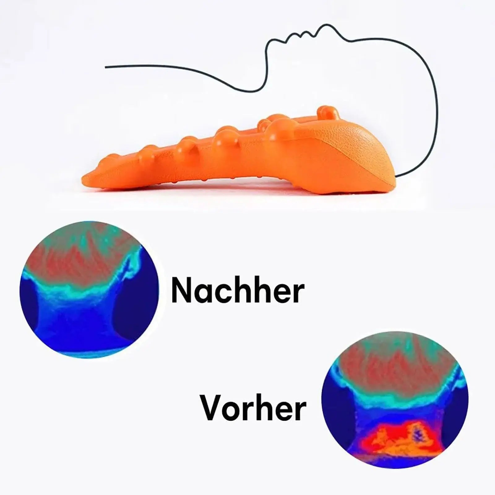 Cervical Neck Stretcher & Traction Device for Pain Relief - 11