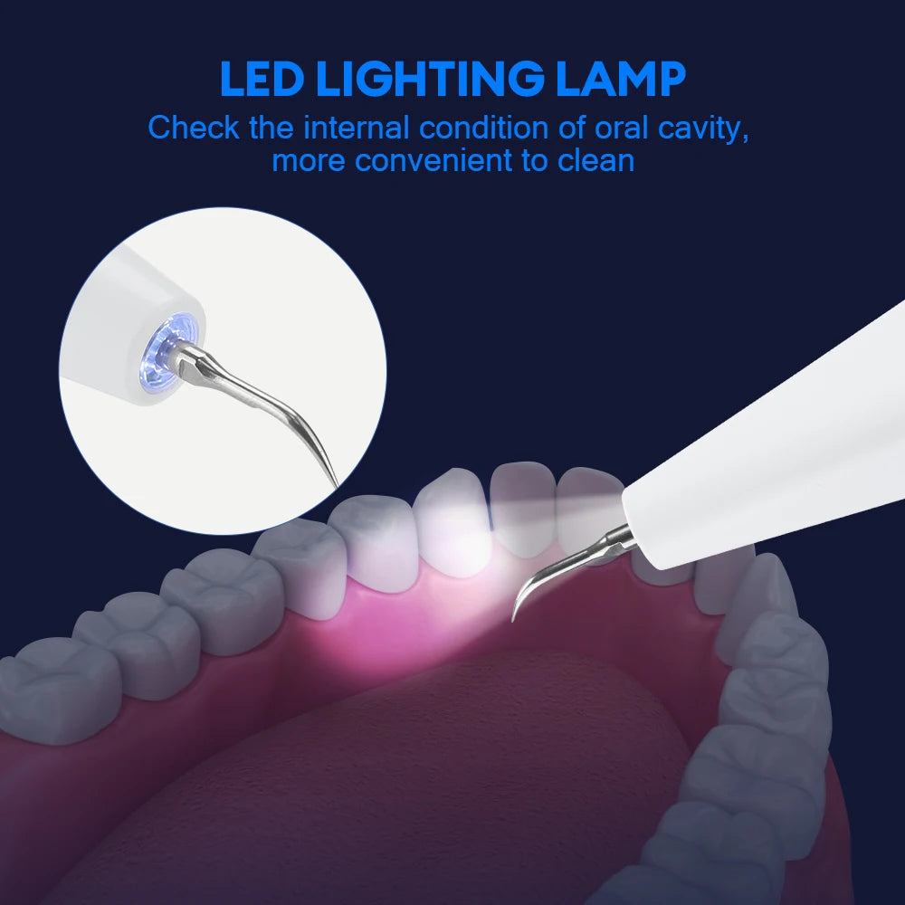 Ultrasonic Electric Teeth Cleaner & Tartar Remover for Professional Oral Care - 6
