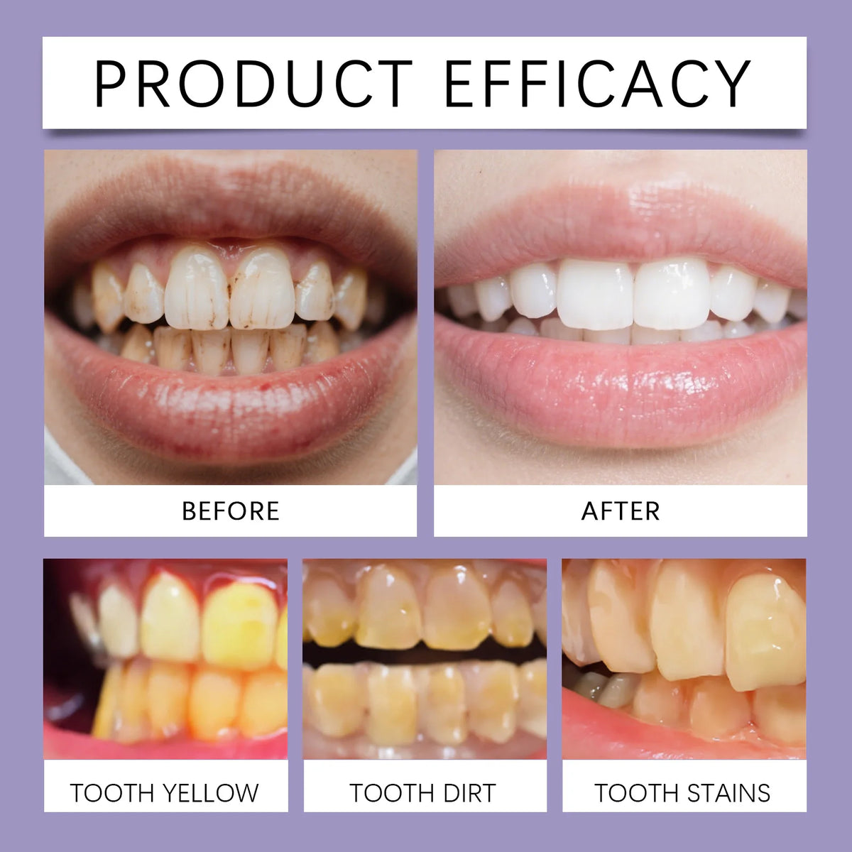 Bee Venom Gum Care Toothpaste for Teeth Whitening and Enamel Repair