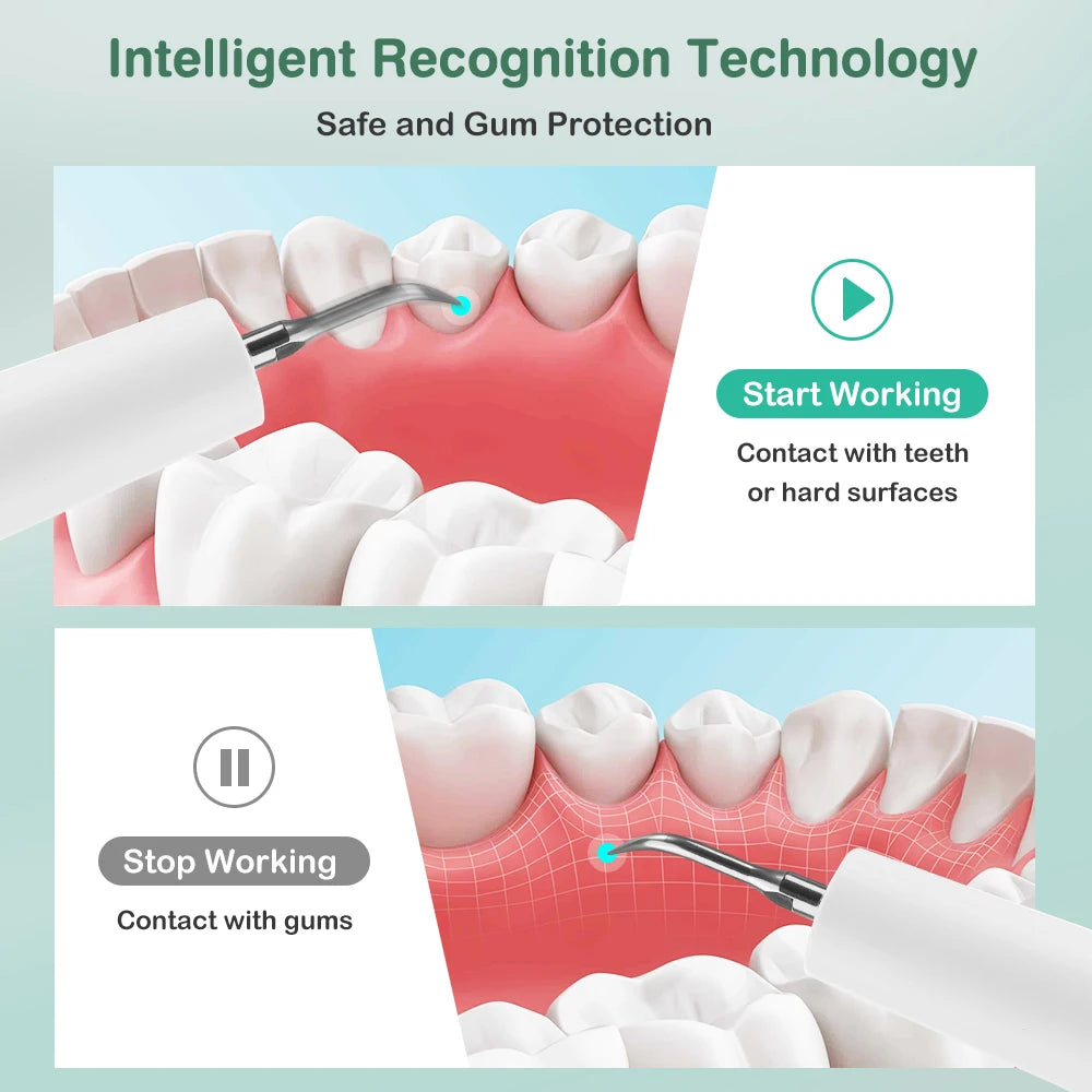 Ultrasonic Electric Teeth Tartar Remover and Plaque Cleaner with LED Display