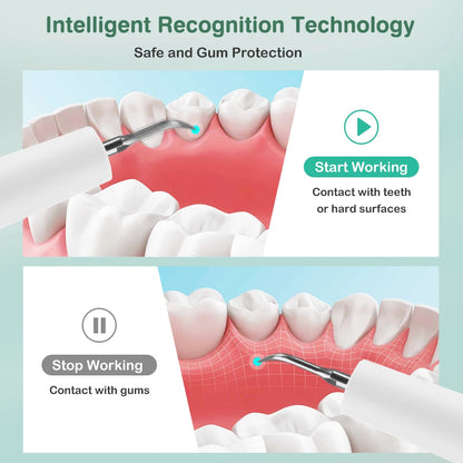 Ultrasonic Electric Teeth Tartar Remover and Plaque Cleaner with LED Display