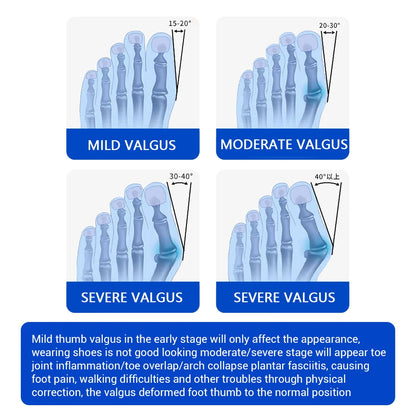 Adjustable Bunion Corrector & Big Toe Straightener for Pain Relief