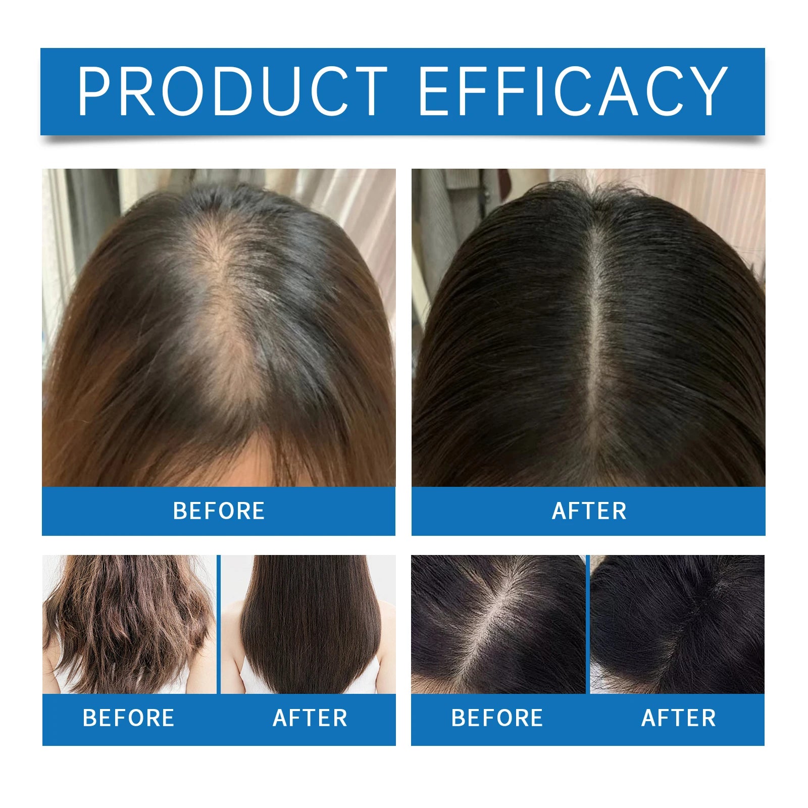 Rosemary Hair Growth Serum Roller for Scalp Stimulation and Damage Repair - 4