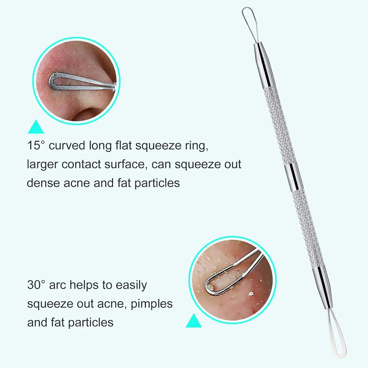 Professional Stainless Steel Blackhead Extractor & Pimple Popper Tool Kit