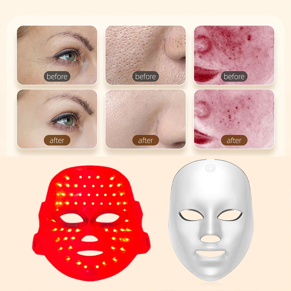 Wireless 7-Color LED Facial Mask for Anti-Aging & Acne