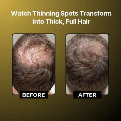 Microneedle Hair Regrowth Serum Kit - Scalp Nourishing & Micro-Infusion Treatment