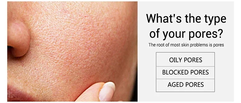 Salicylic Acid Pore Refining Cream - Acne Scar & Blackhead Treatment