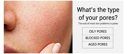 Salicylic Acid Pore Refining Cream - Acne Scar & Blackhead Treatment