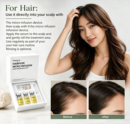 Microneedle Hair Regrowth Serum Kit - Scalp Nourishing & Micro-Infusion Treatment