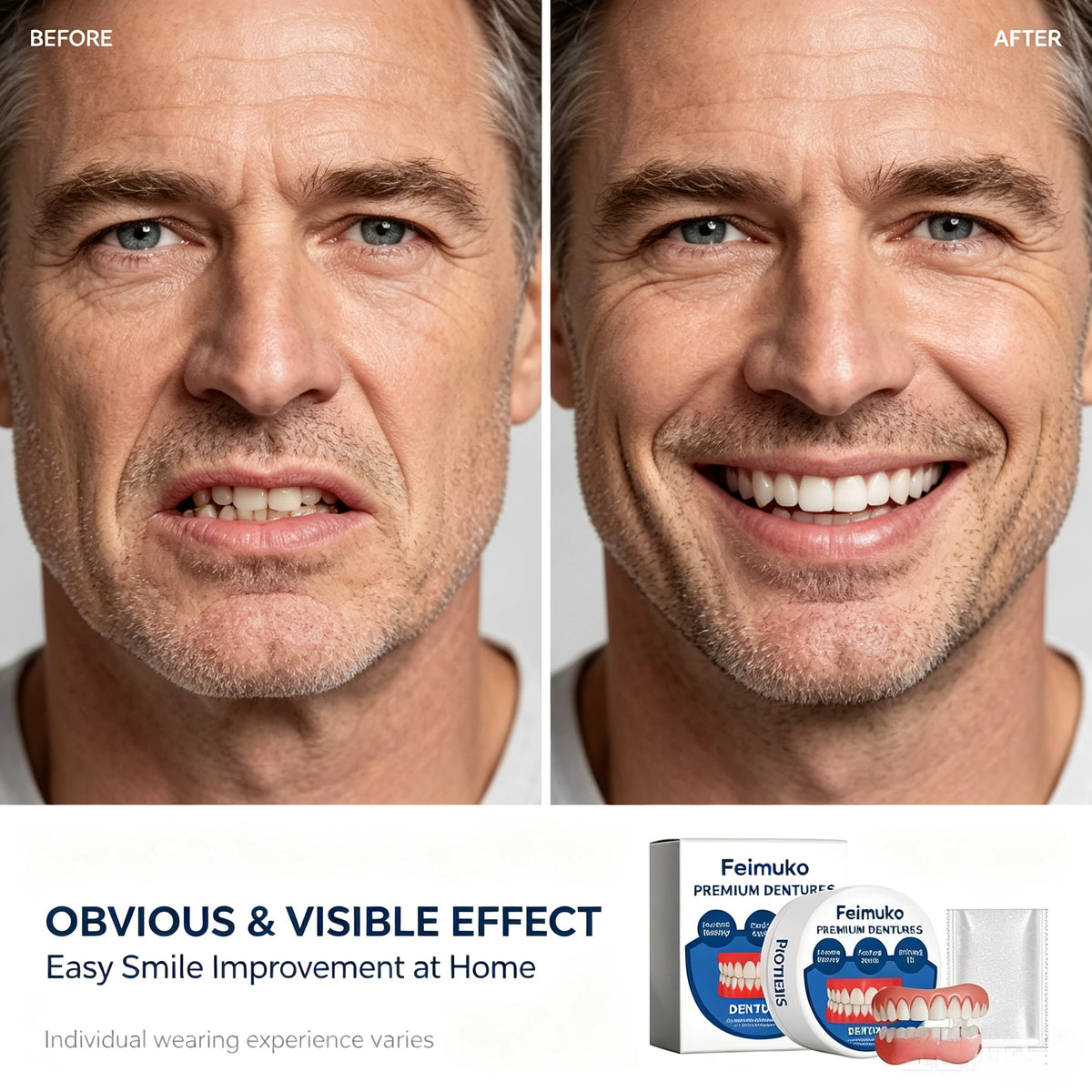 Snap-On Dentures for Instant Realistic Smile - Comfortable Natural Fit