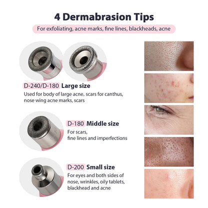 2-in-1 Microdermabrasion Facial Device & Blackhead Vacuum