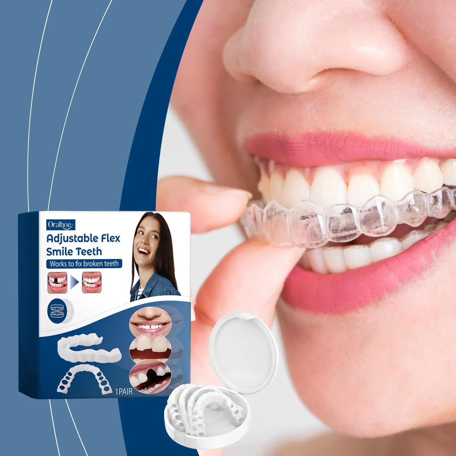 Snap-On Adjustable Smile Veneers for Instant Teeth Coverage and Whitening - 2