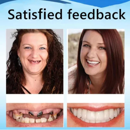 Custom Fit Cosmetic Dentures - Comfortable Silicone Smile Veneers
