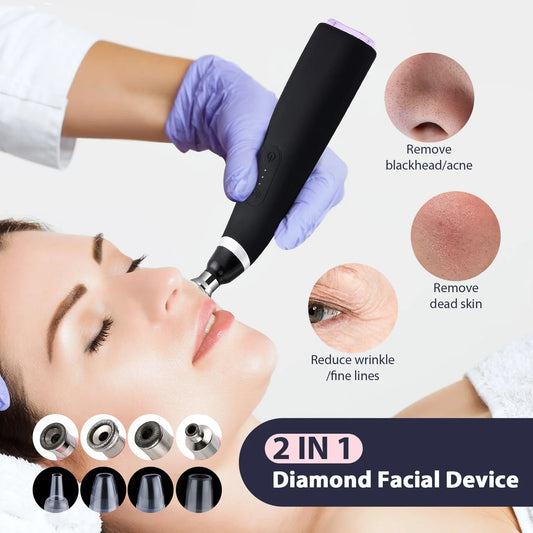 2-in-1 Microdermabrasion Facial Device & Blackhead Vacuum