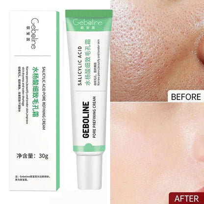 Salicylic Acid Pore Refining Cream - Acne Scar & Blackhead Treatment