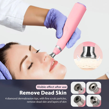 2-in-1 Microdermabrasion Facial Device & Blackhead Vacuum