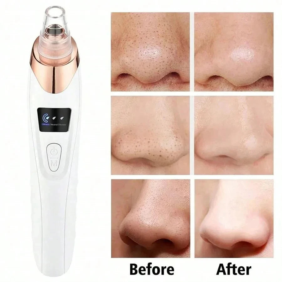 Electric Blackhead Remover & Pore Vacuum Deep Cleansing Device