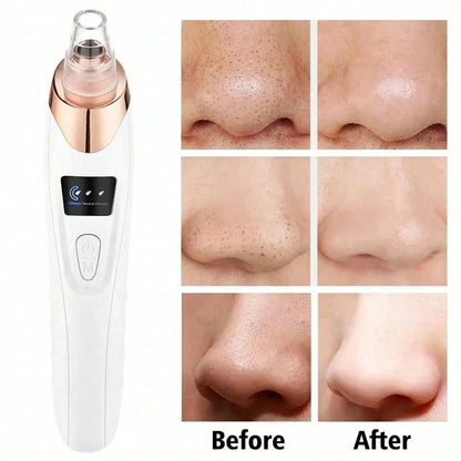 Electric Blackhead Remover & Pore Vacuum Deep Cleansing Device