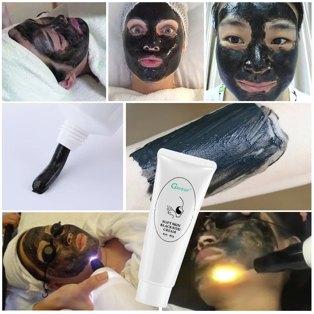 Carbon Laser Facial Gel - Deep Cleansing & Skin Rejuvenation Pore Treatment