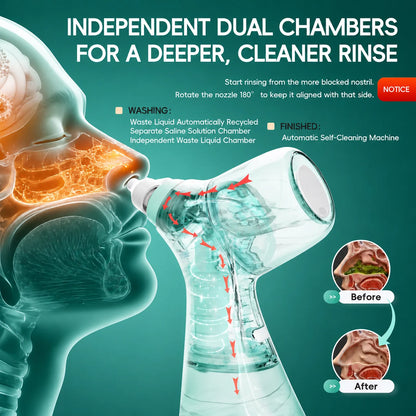 Electric Nasal Irrigator - Sinus Rinse Machine for Congestion Relief