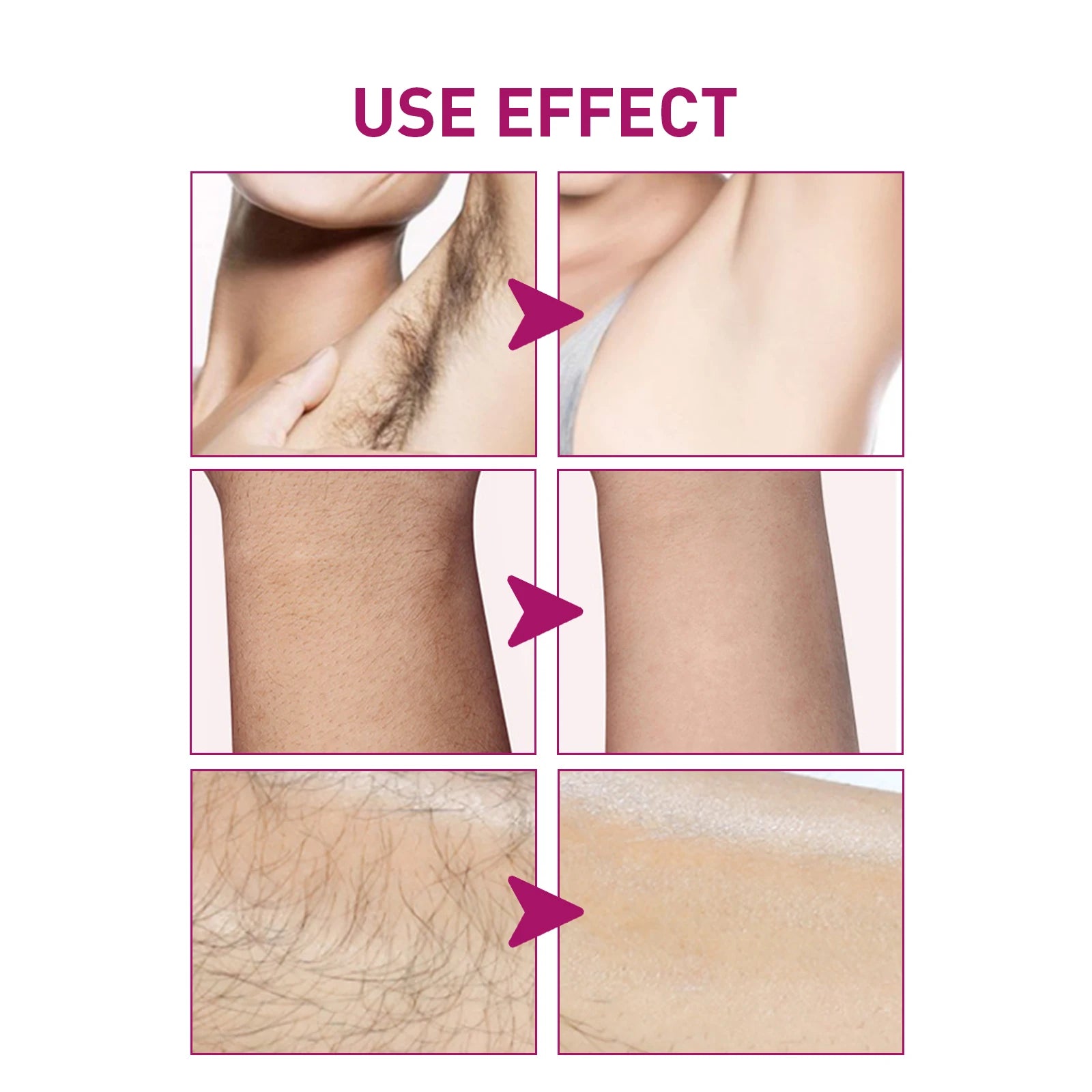 Painless Hair Removal Cream for Men & Women - Fast-Acting Gentle Depilatory - 4