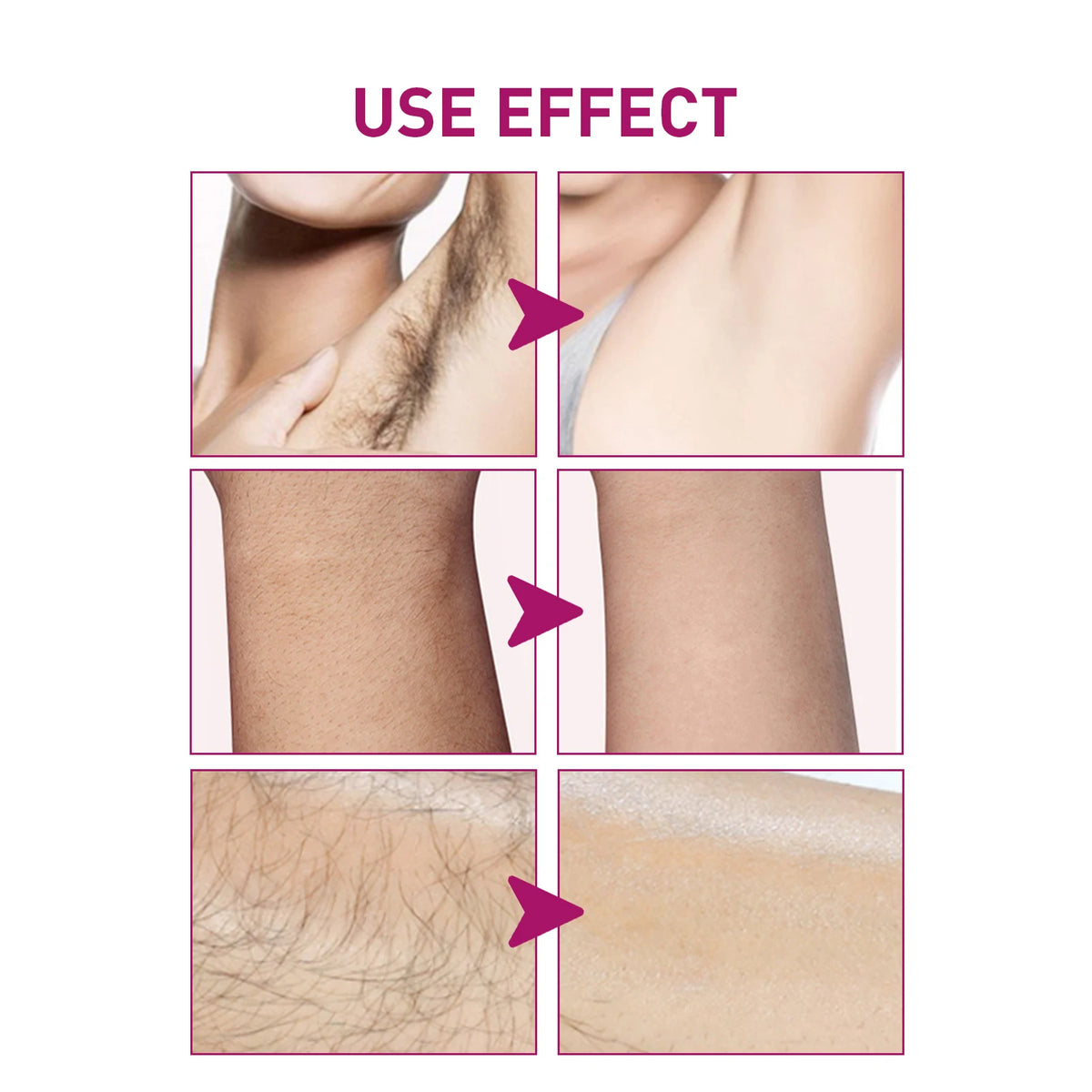 Painless Hair Removal Cream for Men & Women - Fast-Acting Gentle Depilatory