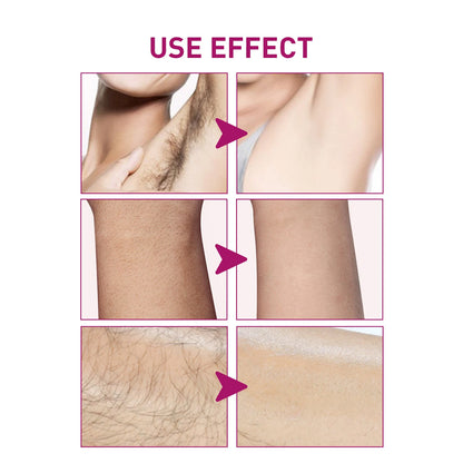 Painless Hair Removal Cream for Men & Women - Fast-Acting Gentle Depilatory