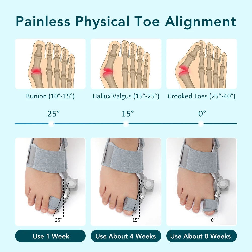 Adjustable Bunion Corrector & Big Toe Straightener for Pain Relief - 15