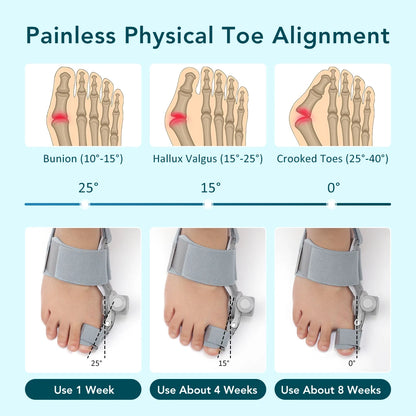 Adjustable Bunion Corrector & Big Toe Straightener for Pain Relief