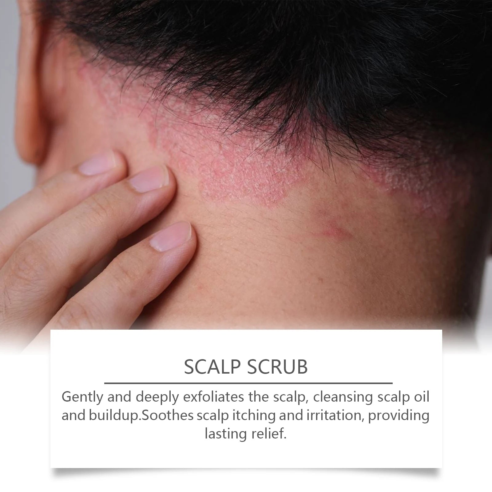 Deep Cleansing Scalp Scrub Exfoliator for Dandruff Relief and Oil Control - 9