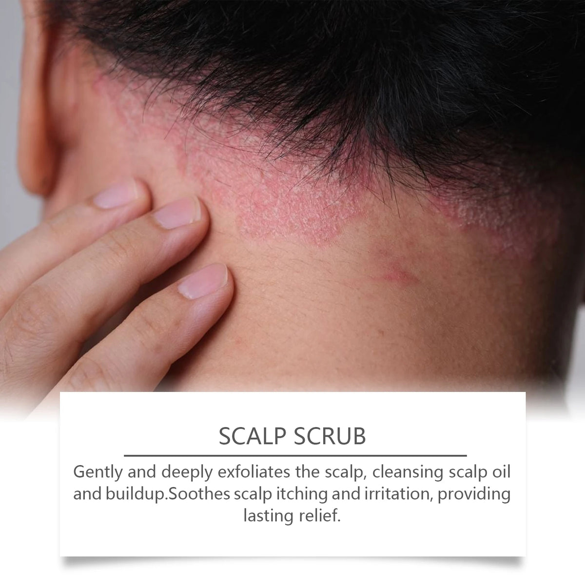 Deep Cleansing Scalp Scrub Exfoliator for Dandruff Relief and Oil Control