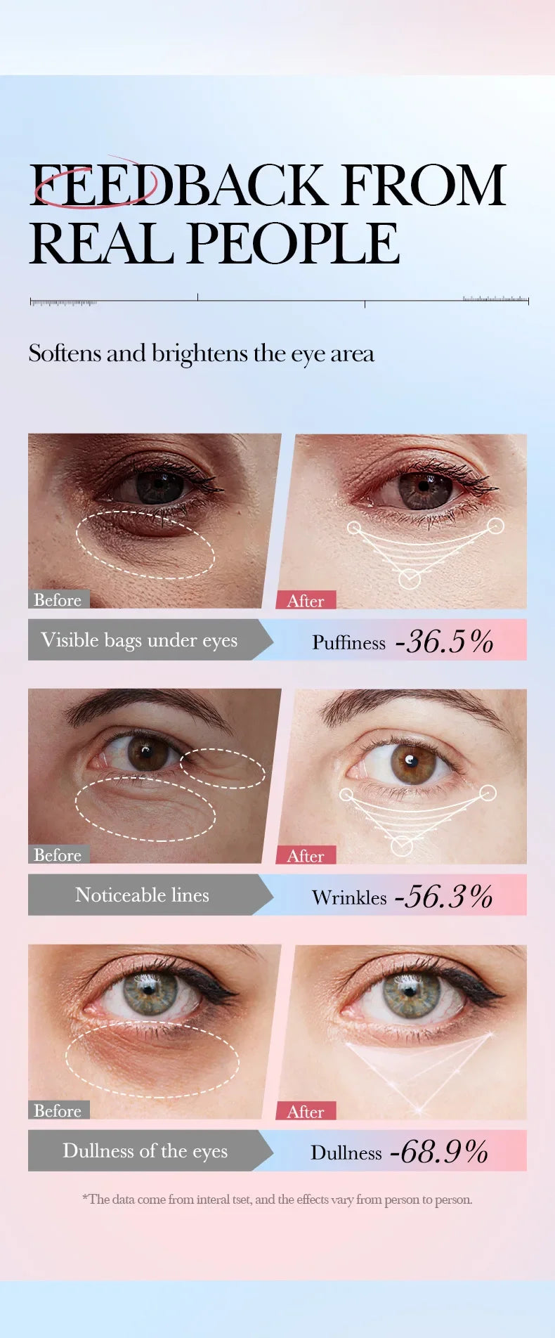 Retinol 4-in-1 Roll-On Eye Cream for Dark Circles & Puffiness Removal - 17