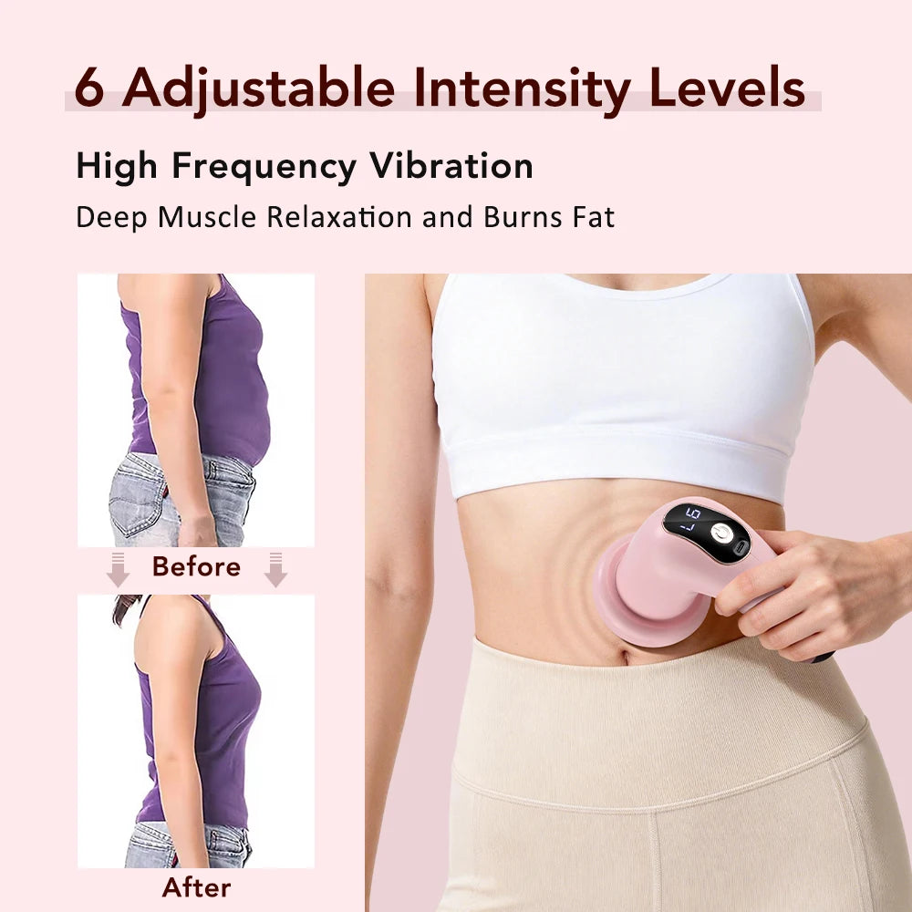 5-in-1 Electric Body Slimming & Cellulite Removal Massage Device