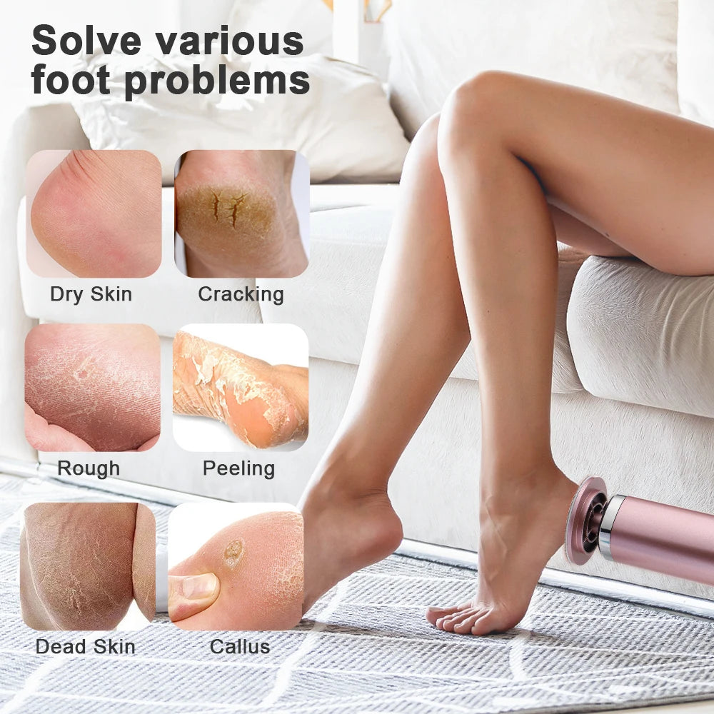 Electric Foot Callus Remover & Rechargeable Pedicure Tool