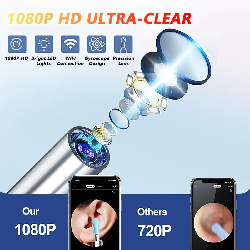 Smart Visual Ear Wax Remover - 1080P HD Camera Otoscope Cleaner - 7