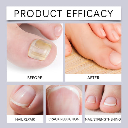 Nail Repair Essence Pen - Deep Nourishing Cuticle Oil for Dry, Damaged Nail Care