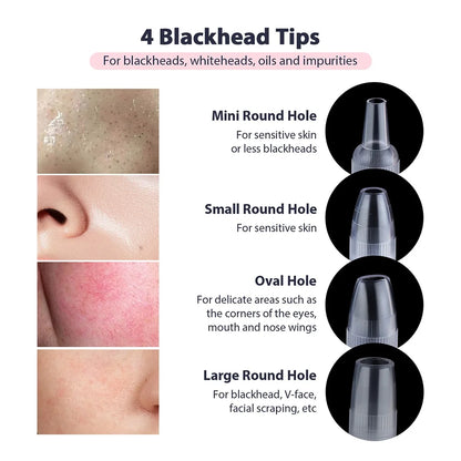 2-in-1 Microdermabrasion Facial Device & Blackhead Vacuum