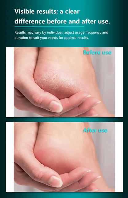 Professional Stainless Steel Foot File for Pedicure & Cracked Heel Removal