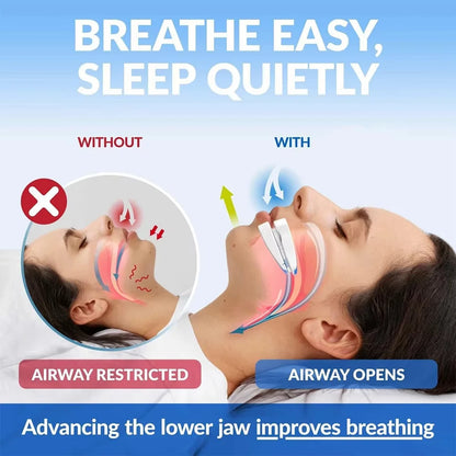 Adjustable Anti-Snoring Mouth Guard Sleep Mouthpiece for Bruxism & Snoring Relief