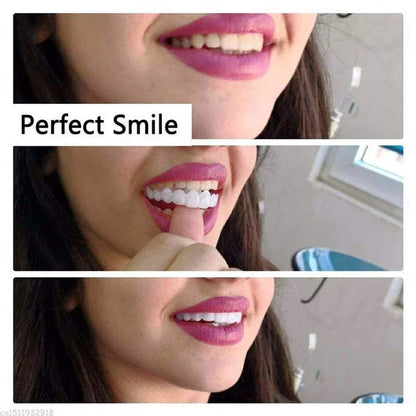 Snap-On Smile Veneers Kit – Instant Temporary Teeth Whitening & Cosmetic Cover