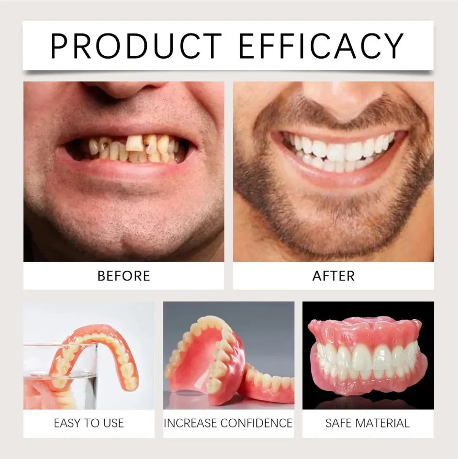 Instant Smile Full Mouth Resin Denture Set – Realistic & Comfortable Dental Veneer - 3