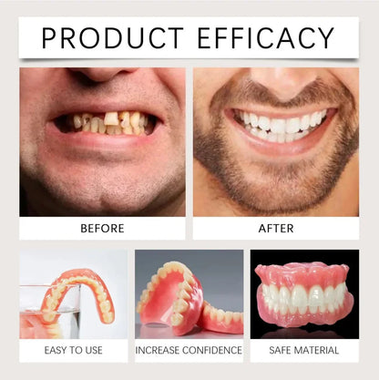 Instant Smile Full Mouth Resin Denture Set – Realistic & Comfortable Dental Veneer