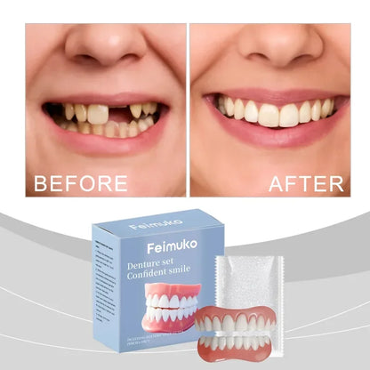 Premium Temporary Smile Veneers - Comfortable Fit for Missing or Chipped Teeth
