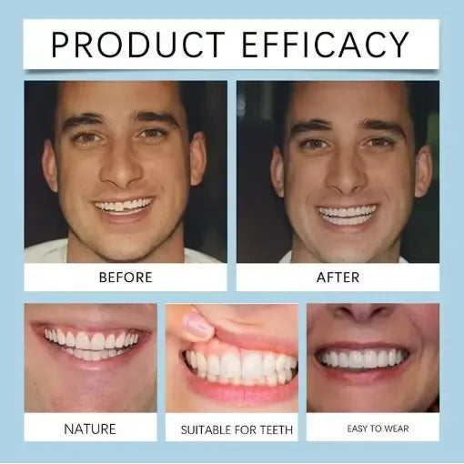Flexible Silicone Denture Set – Natural Looking Smile Veneer for Upper and Lower Teeth