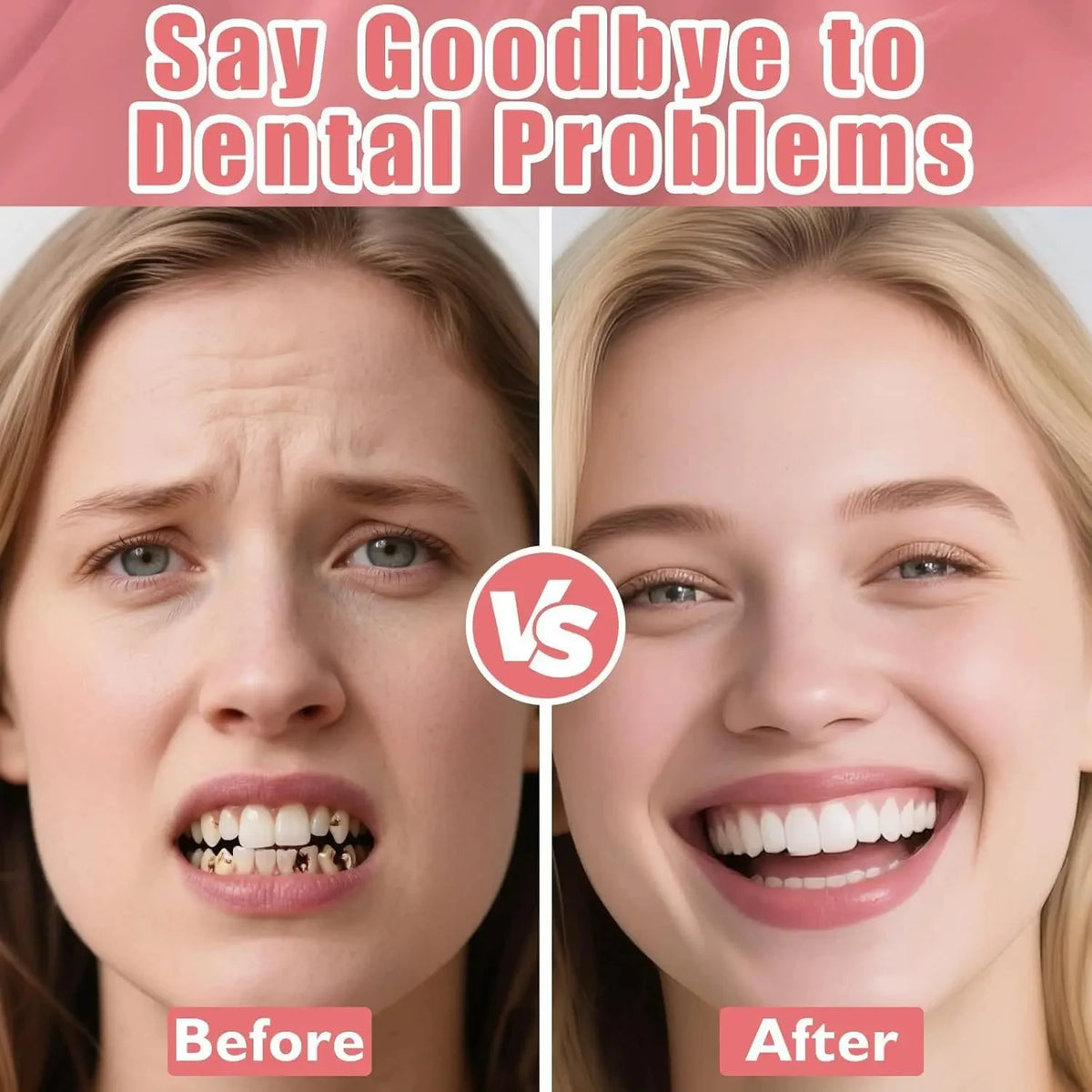 Natural Texture Realistic Full Denture Set for a Comfortable and Confident Smile